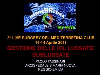 3° LIVE SURGERY DEL MEDITERRETINA CLUB 14-14 Aprile 2011 GESTIONE DELLE IOL LUSSATE/ SUBLUSSATE