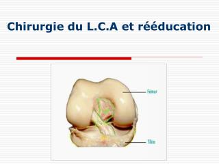 Chirurgie du L.C.A et rééducation