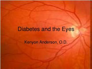 Diabetes and the Eyes