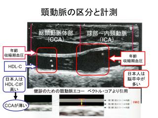 頸動脈の区分と計測