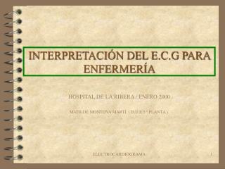 INTERPRETACIÓN DEL E.C.G PARA ENFERMERÍA