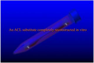 An ACL substitute completely reconstructed in vitro