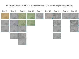 M. tuberculosis in MODS x20 objective (sputum sample inoculation)