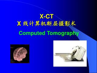 X-CT X 线计算机断层摄影术