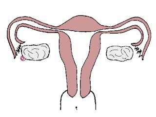 Fallopian Tubes