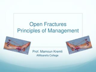 Open Fractures Principles of Management