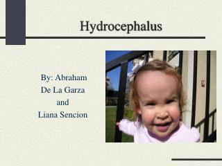 Hydrocephalus