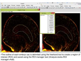In the “Analyze” menu, select “set measurements” and click on area and “mean gray value”.