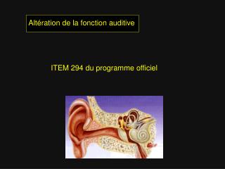 Altération de la fonction auditive 	ITEM 294 du programme officiel