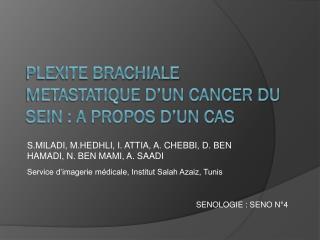 PLEXITE BRACHIALE METASTATIQUE D’UN CANCER DU SEIN : A PROPOS D’UN CAS