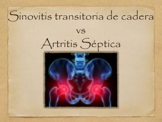 Sinovitis transitoria de cadera vs Artritis Séptica