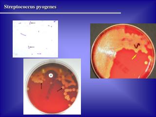 Streptococcus pyogenes