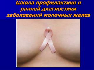 Школа профилактики и ранней диагностики заболеваний молочных желез