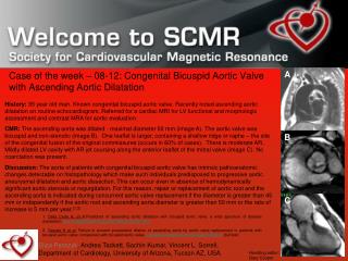 Case of the week – 08-12: Congenital Bicuspid Aortic Valve with Ascending Aortic Dilatation