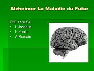 Alzheimer La Maladie du Futur