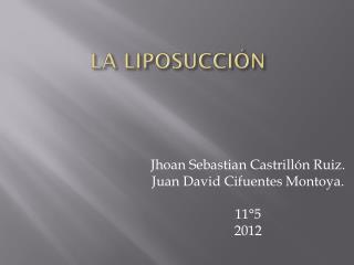 LA LIPOSUCCIÓN