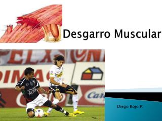 “ Desgarro Muscular ”