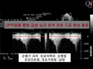 CP 적용을 통한 급성 심근 경색 관련 지표 향상 활동