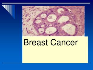 Breast Cancer