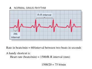 Rate in beats/min = 60/interval between two beats in seconds