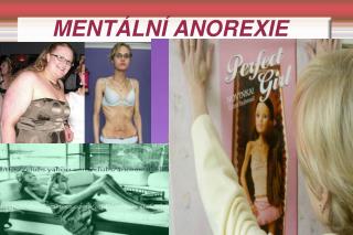 MENTÁLNÍ ANOREXIE