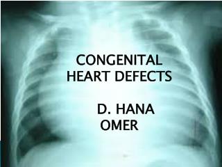 CONGENITAL HEART DEFECTS D. HANA OMER