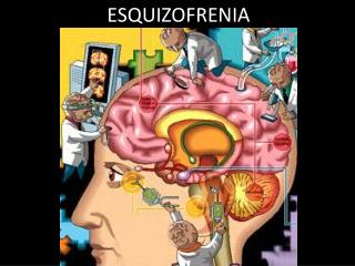 ESQUIZOFRENIA