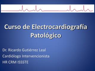 Curso de Electrocardiografía Patológico