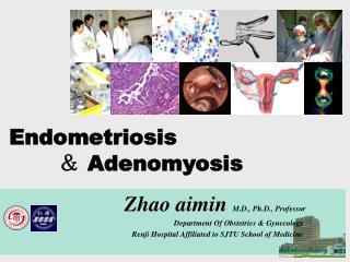 Endometriosis ＆ Adenomyosis