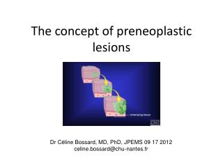 The concept of preneoplastic lesions