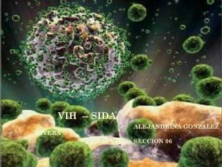 VIH -- SIDA