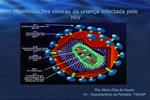 Manifesta es cl nicas da crian a infectada pelo HIV