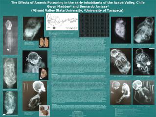 The Effects of Arsenic Poisoning in the early inhabitants of the Azapa Valley, Chile