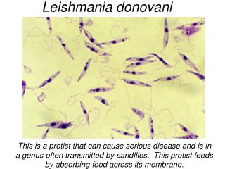 Leishmania donovani