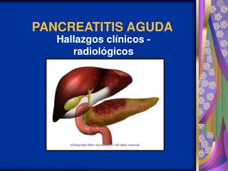 PANCREATITIS AGUDA