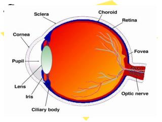 Developmental cataract