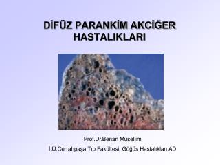 DİFÜZ PARANKİM AKCİĞER HASTALIKLARI