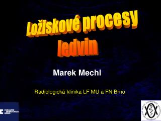 Ložiskové procesy ledvin