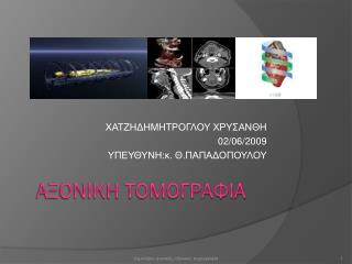 Αξονικη τομογραφια