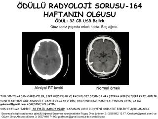 ÖDÜLLÜ RADYOLOJİ SORUSU-164 HAFTANIN OLGUSU ÖDÜL: 32 GB USB Bellek