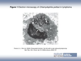 Figure 1 Electron microscopy of Chlamydophila psittaci in lymphoma