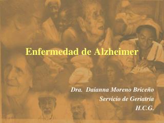 Enfermedad de Alzheimer
