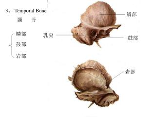 3 、 Temporal Bone 颞 骨