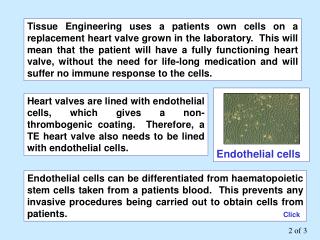 Endothelial cells