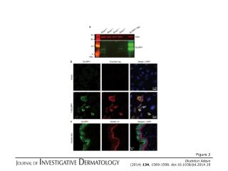 Oludotun Adeyo (2014) 134 , 1589-1598. doi:10.1038/jid.2014.19