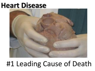 Heart Disease