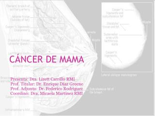 CÁNCER DE MAMA