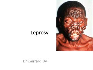 Leprosy