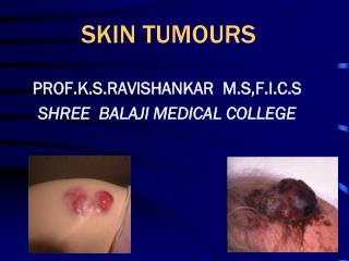 SKIN TUMOURS