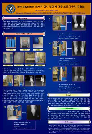 Heel alignment view 의 검사 변화에 따른 보조기구의 유용성